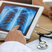 https://connect.bcbsil.com/cfs-file/__key/communityserver-blogs-components-weblogfiles/00-00-00-00-02/lung-health.jpg