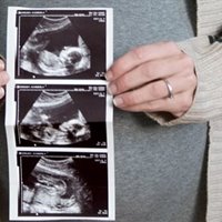 https://connect.bcbsil.com/cfs-file/__key/communityserver-blogs-components-weblogfiles/00-00-00-00-08/PregnancyBabyUltrasound.jpg