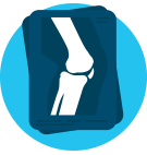 illustration of a knee x-ray